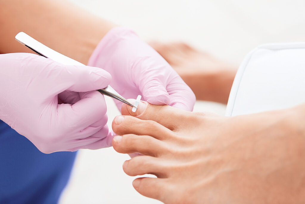 Medizinische Fußpflege Golden Care Fußpflege